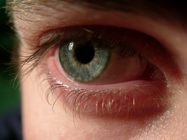 ojo humano
