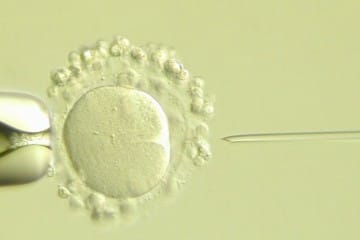 Inseminación artificial