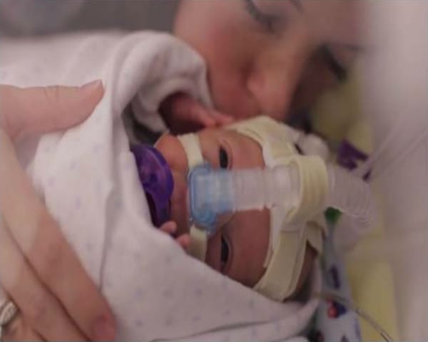 VIDEO: El amor por su hijo logra que siga con vida.