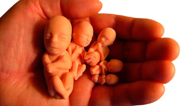 El aborto comenzó el día que empezamos a acostarnos