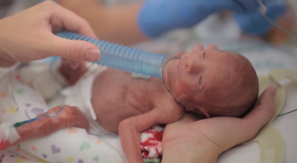 Extraordinario video: El primer año de Ward Miles